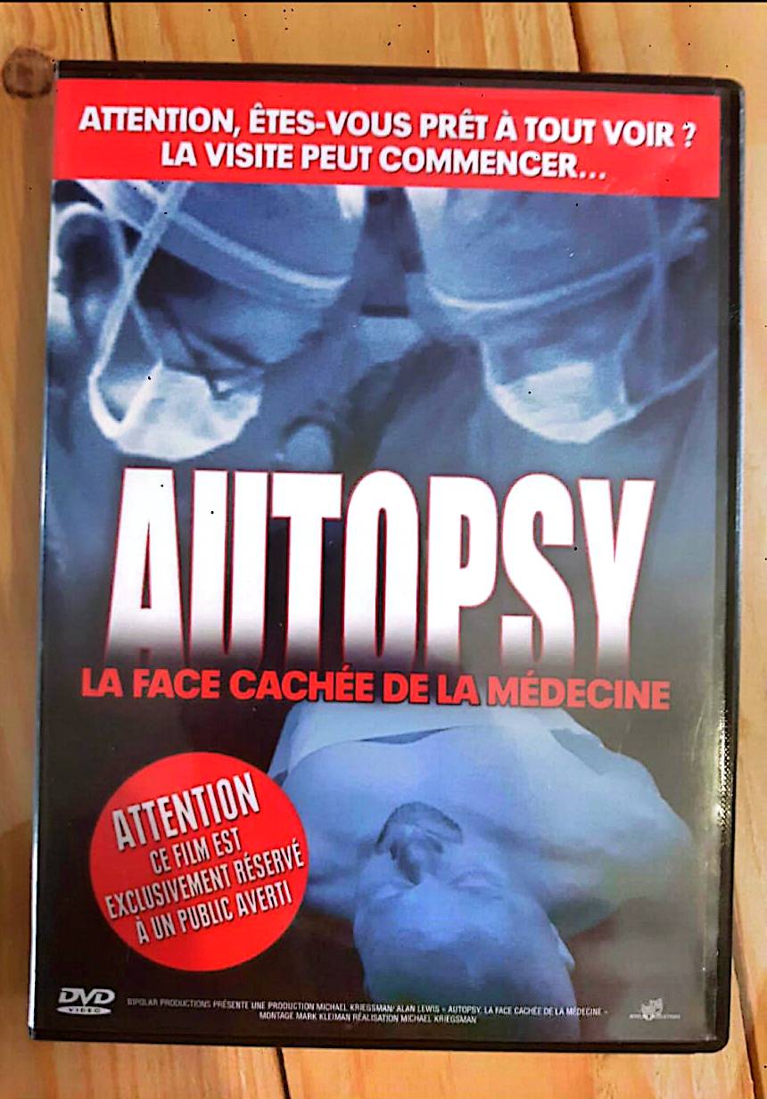 DVD : Autopsy