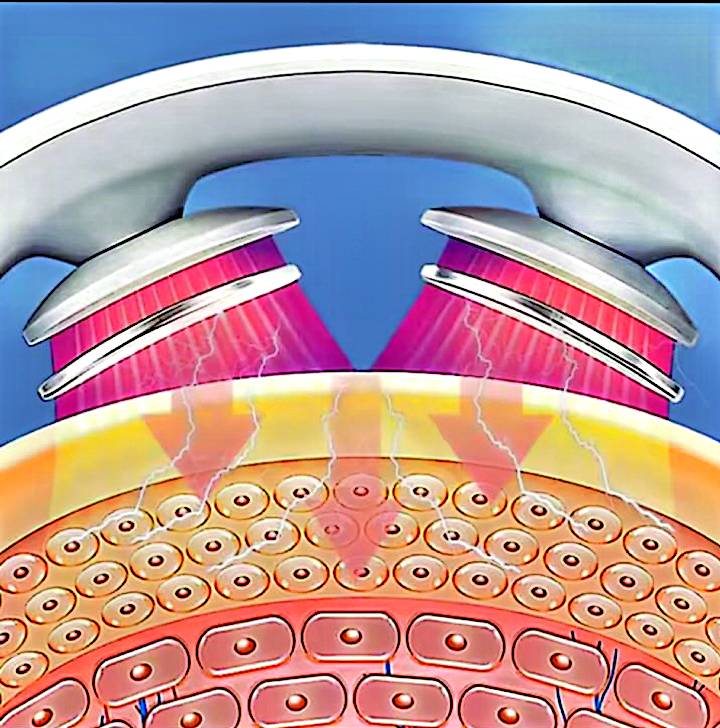 Masseur Cervical Intelligent Chauffant – Soulage Douleurs au Cou et Trapèzes – Électrostimulation, Chaleur, Léger et Rechargeable – Livraison Rapide 🇫🇷 – neuf