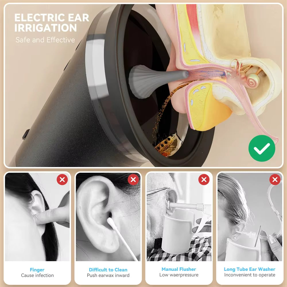 Système Électrique de Nettoyage des Oreilles – Irrigateur Auriculaire Rechargeable avec 3 Réglages de Pression – Élimination du Cérumen par Rinçage à Eau