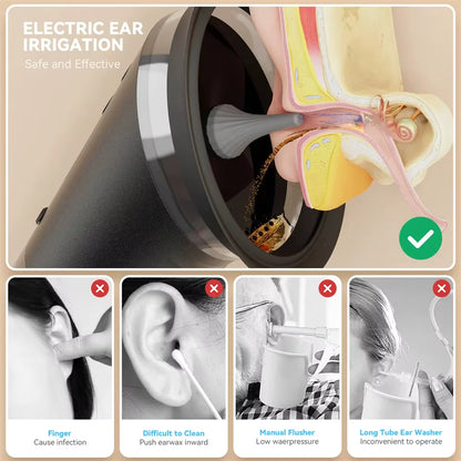 Système Électrique de Nettoyage des Oreilles – Irrigateur Auriculaire Rechargeable avec 3 Réglages de Pression – Élimination du Cérumen par Rinçage à Eau